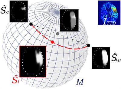 Learning to Predict Ischemic Stroke Growth on Acute CT Perfusion Data by Interpolating Low-Dimensional Shape Representations